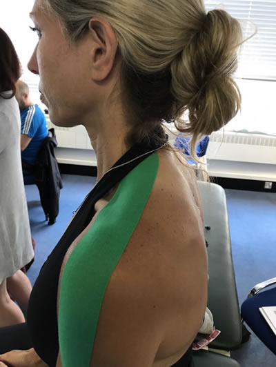 Exercise with medical conditions or after injury