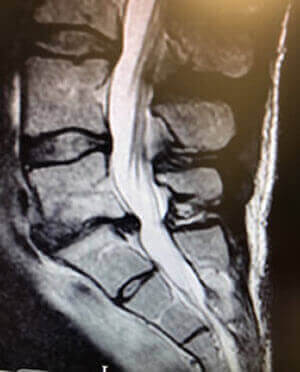 Exercise with medical conditions or after injury